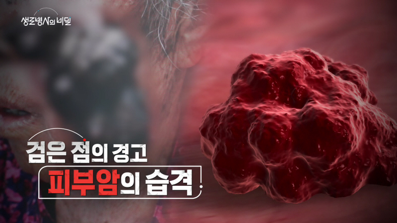 생로병사의 비밀