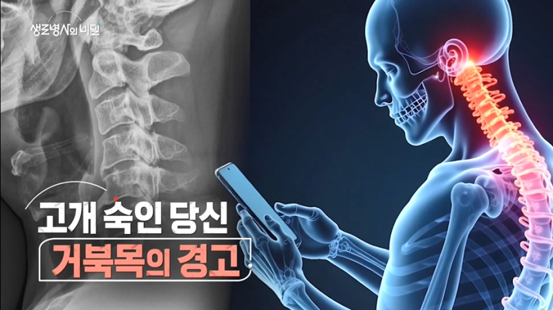 생로병사의 비밀